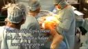 Mini hip replacement Operation India, Dr Venkatachalam